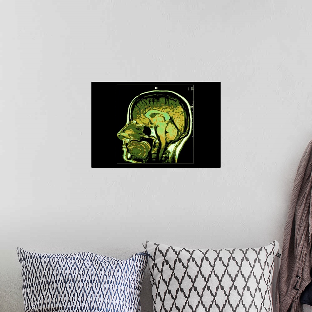 A bohemian room featuring Cross section image of human head