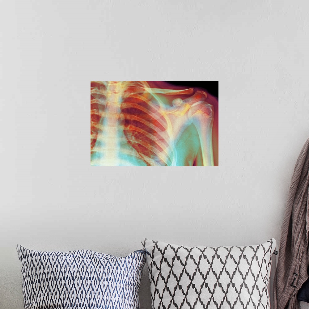 A bohemian room featuring Normal shoulder. Coloured X-ray of the shoulder of a 19 year old man.