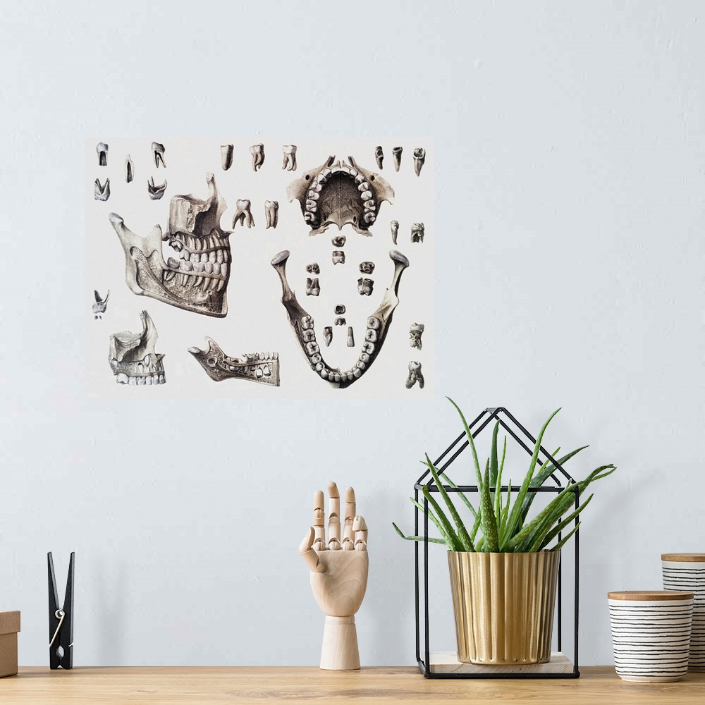 A bohemian room featuring Dental anatomy. Historical anatomical artwork of healthy and diseased human teeth and jaws. The t...