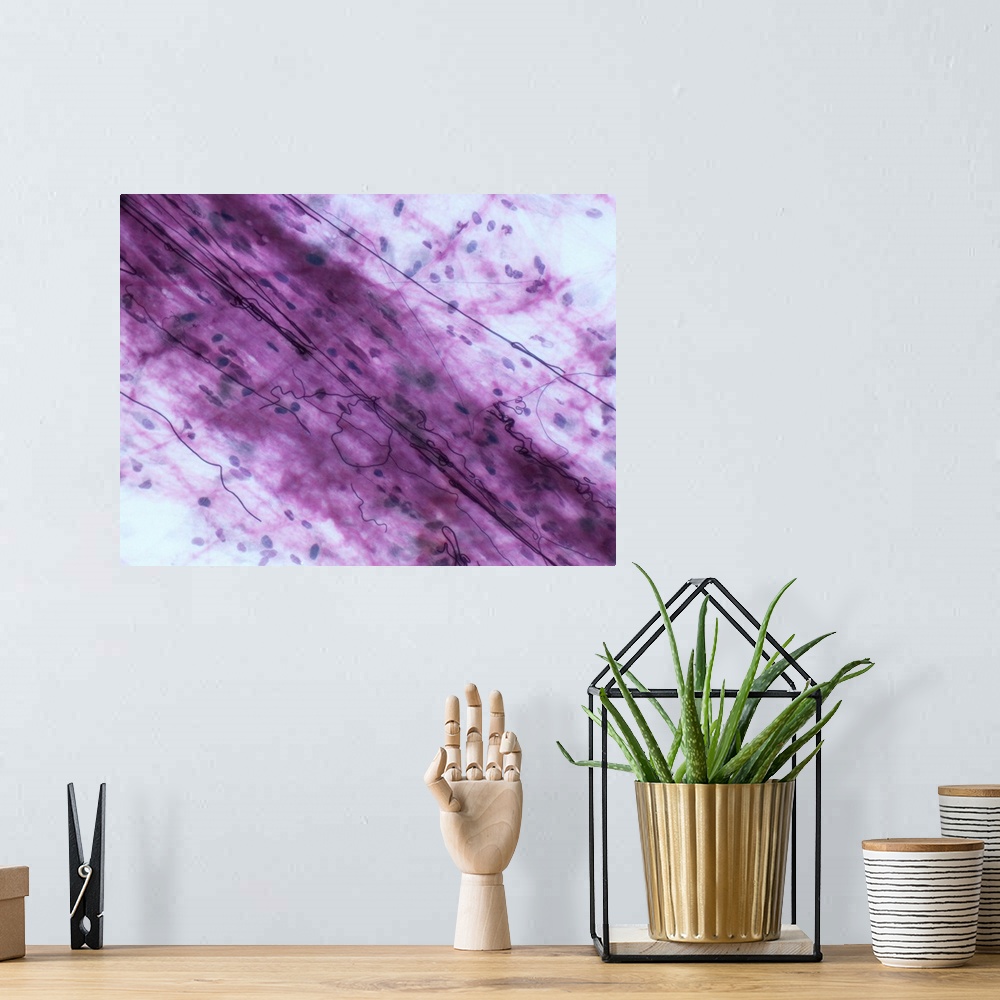 A bohemian room featuring Light micrograph (LM) of loose connective tissue to show elastin fibers. Elastin fibres form a 3D...