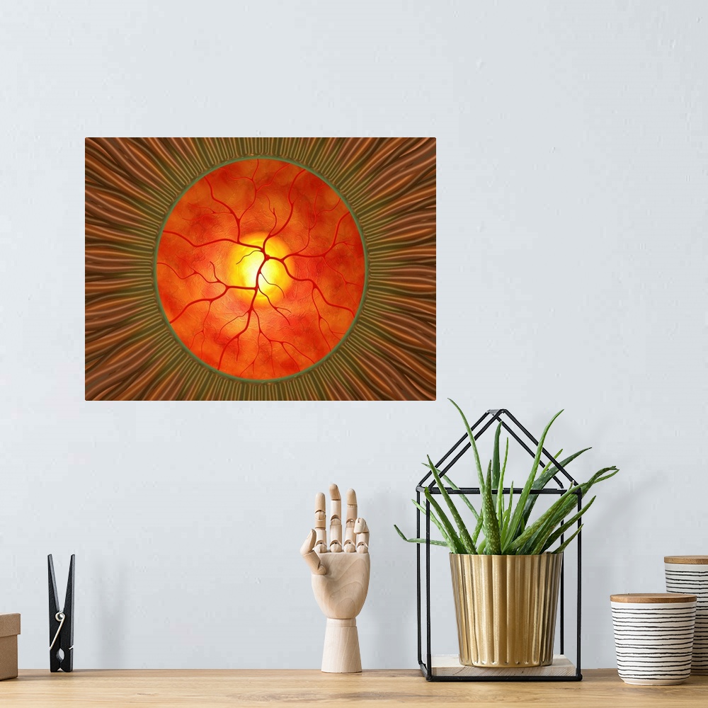 A bohemian room featuring Retina in glaucoma, computer artwork. This view is looking through the pupil (green ring) at the ...