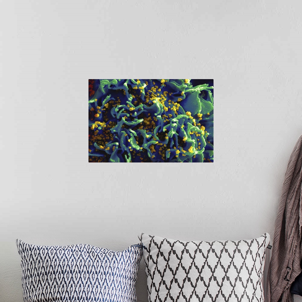 A bohemian room featuring Scanning electron micrograph of HIV particles infecting a human T cell.
