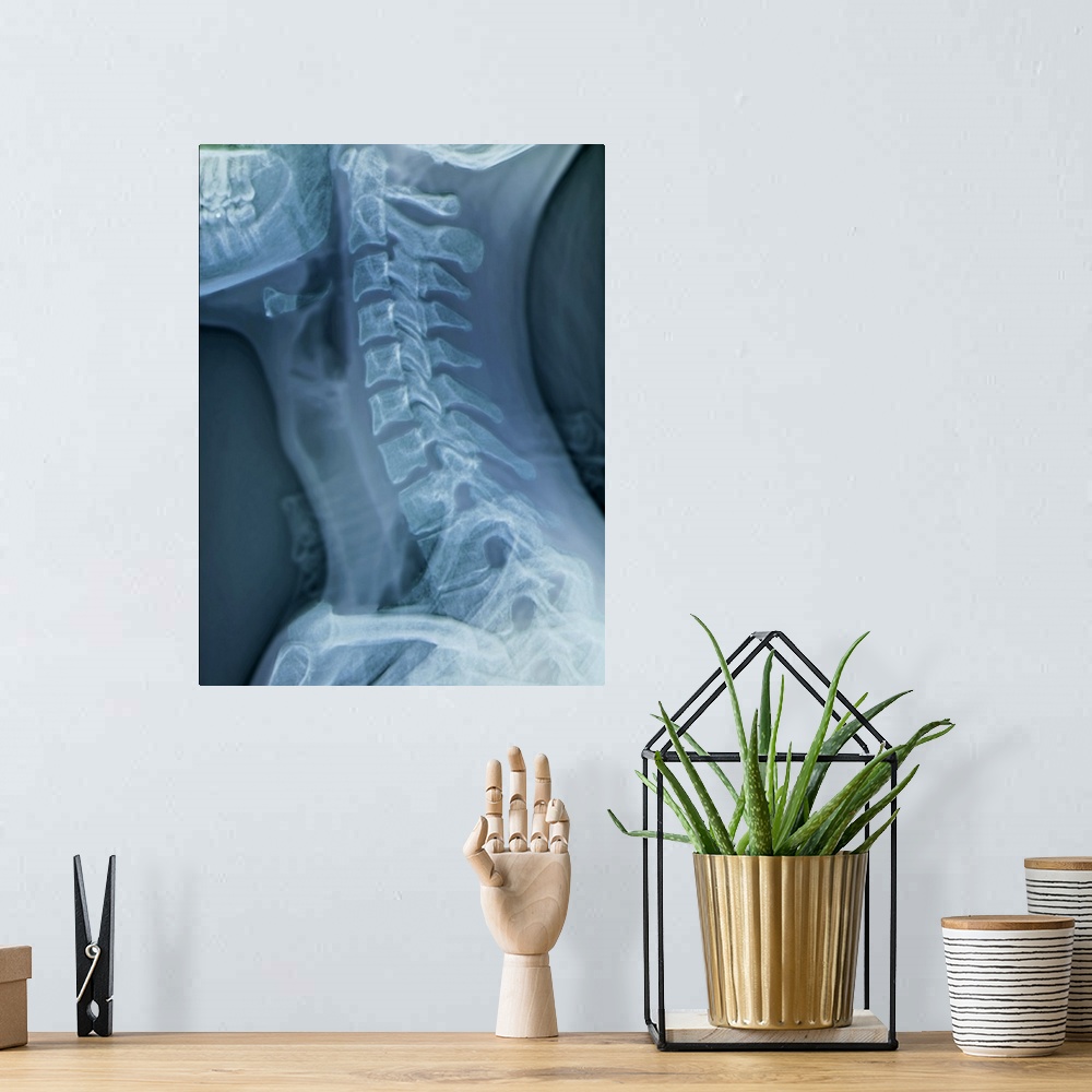 A bohemian room featuring Normal neck. Coloured X-ray of the cervical spine of a 27 year old.
