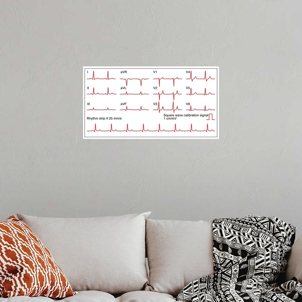 A bohemian room featuring Electrocardiograms (ECG) of a normal heart rate, artwork. An ECG measures the electrical activity...
