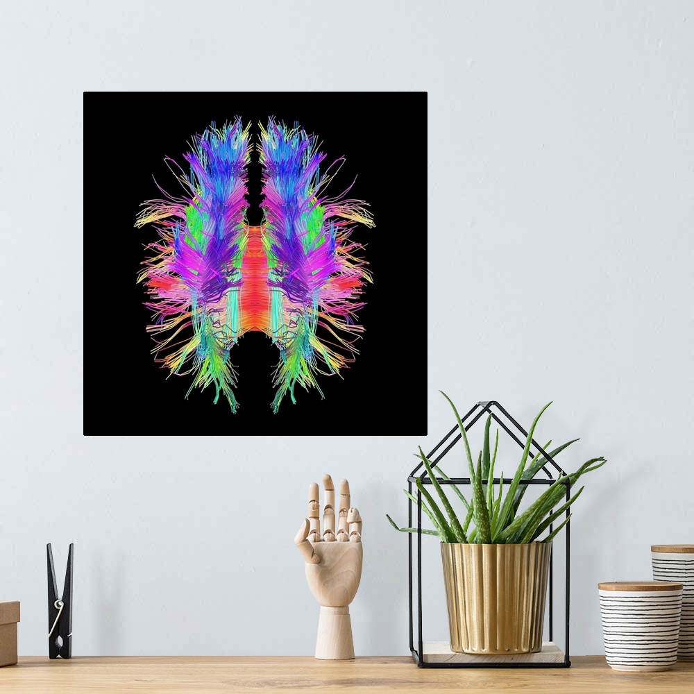 A bohemian room featuring White matter fibres overlaid a 3d model of the human brain in top view. Coloured 3D diffusion spe...