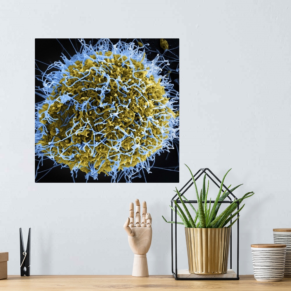 A bohemian room featuring Colorized scanning electron micrograph of filamentous Ebola virus particles (blue) budding from a...