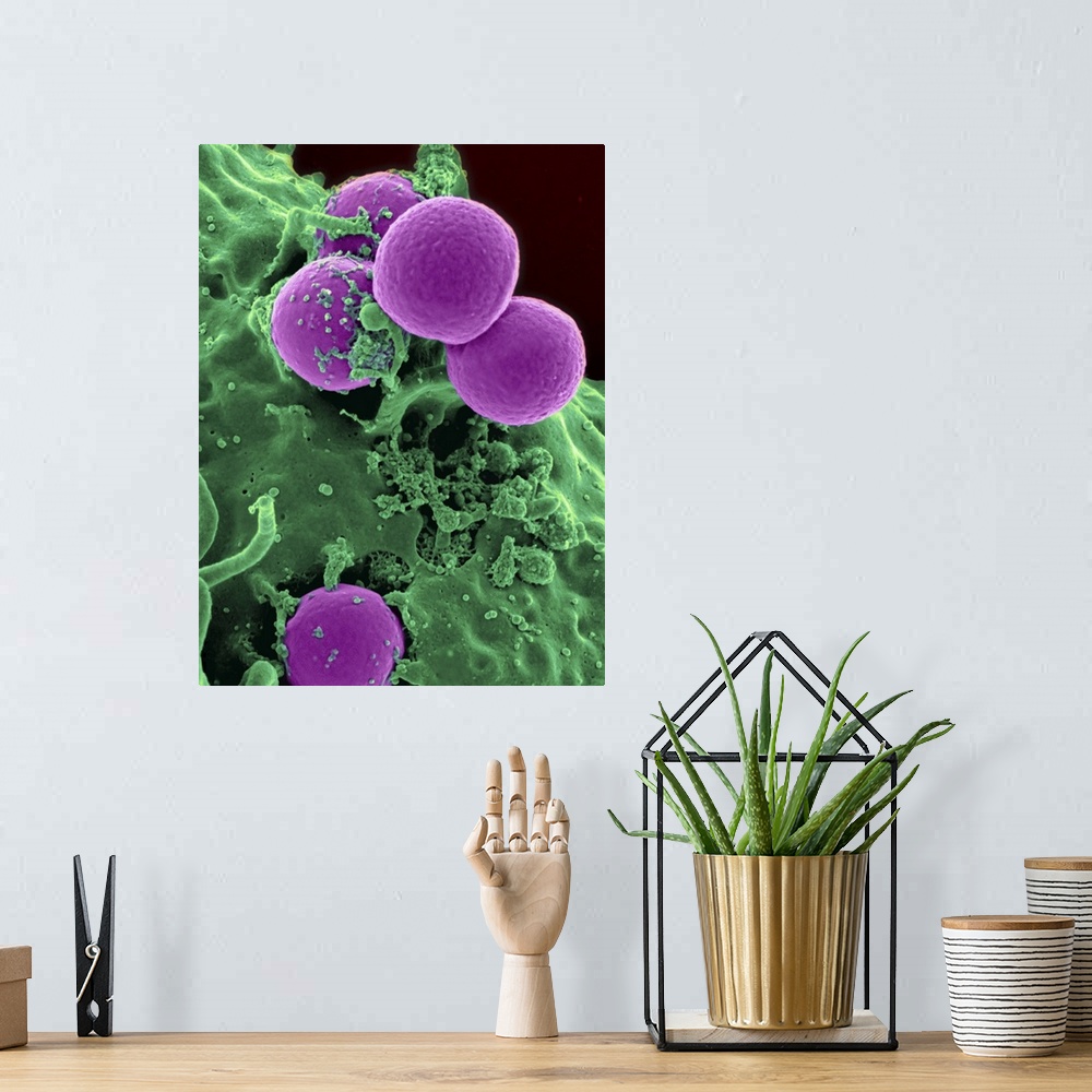 A bohemian room featuring Scanning electron micrograph of a human neutrophil ingesting MRSA.