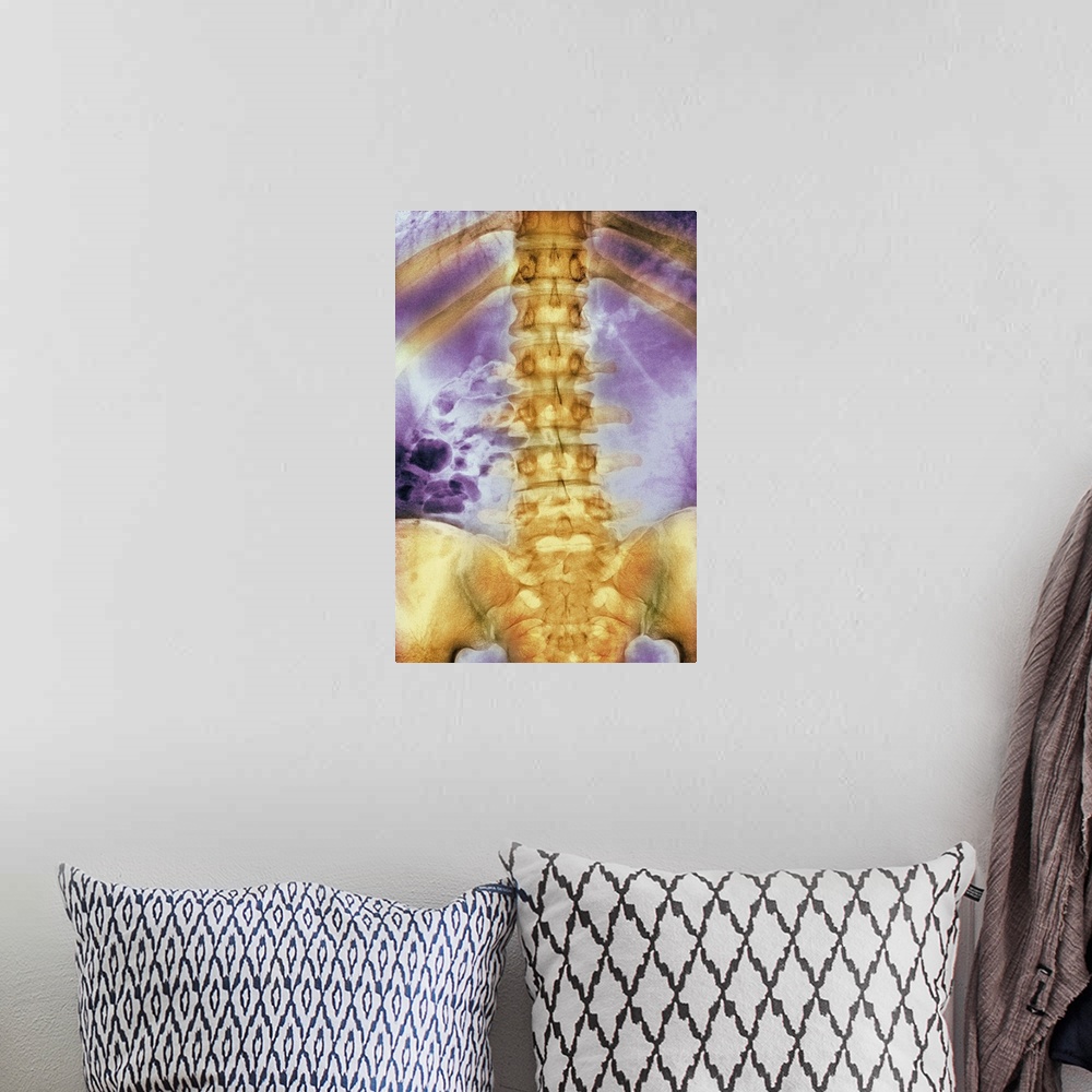 A bohemian room featuring Normal spine. Coloured X-ray of the spine of a 24 year old man.
