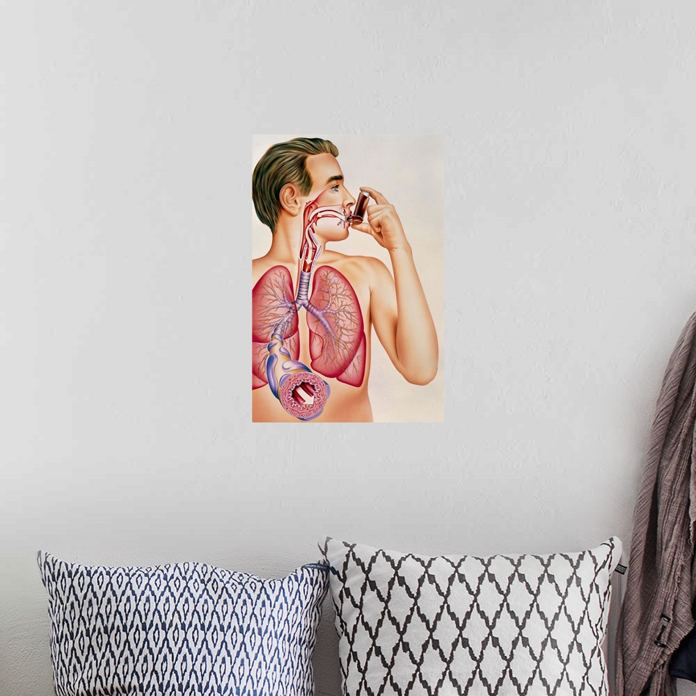 A bohemian room featuring Asthma inhaler. Artwork showing the effects of an asthma inhaler containing bronchodilator drugs ...