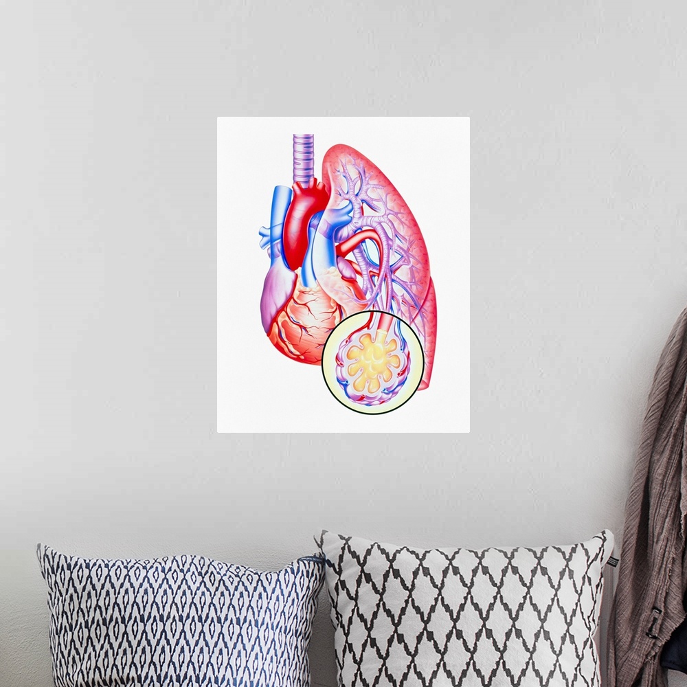 A bohemian room featuring Lung oedema in heart failure. Illustration showing leakage of fluid (oedema) into the lung due to...