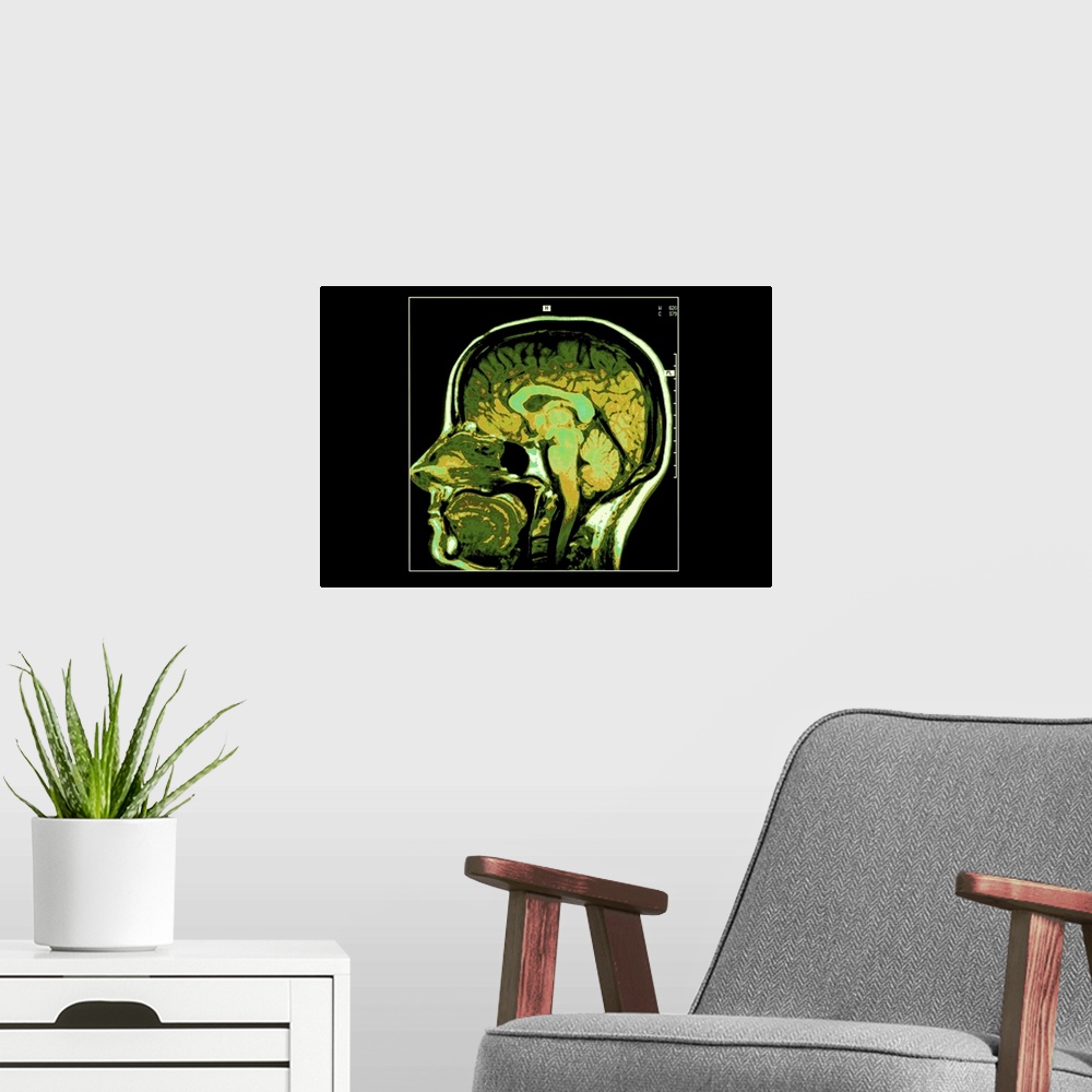 A modern room featuring Cross section image of human head