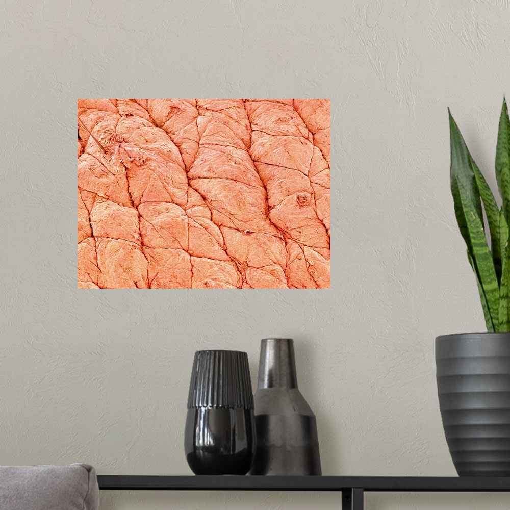 A modern room featuring Human skin at a magnification of x40.