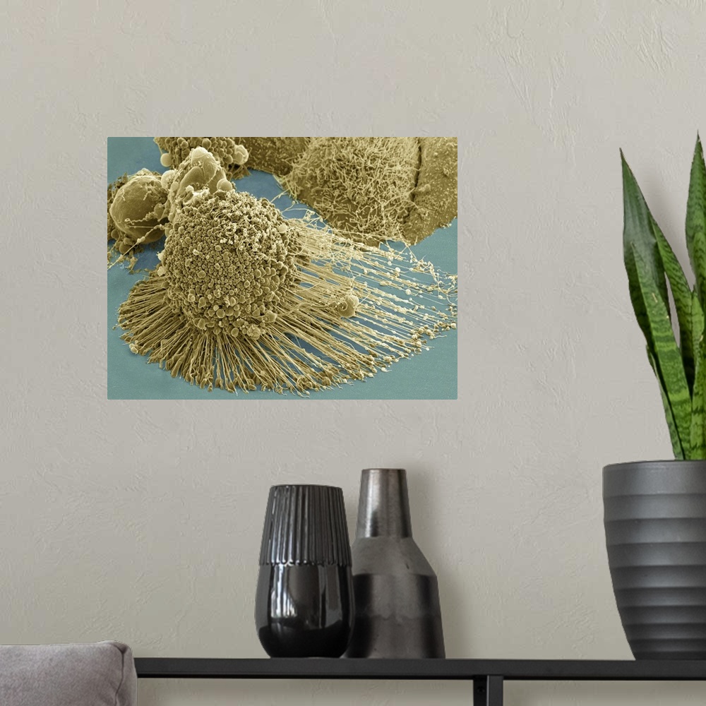 A modern room featuring Scanning electron micrograph of an apoptotic HeLa cell. Zeiss Merlin HR-SEM.