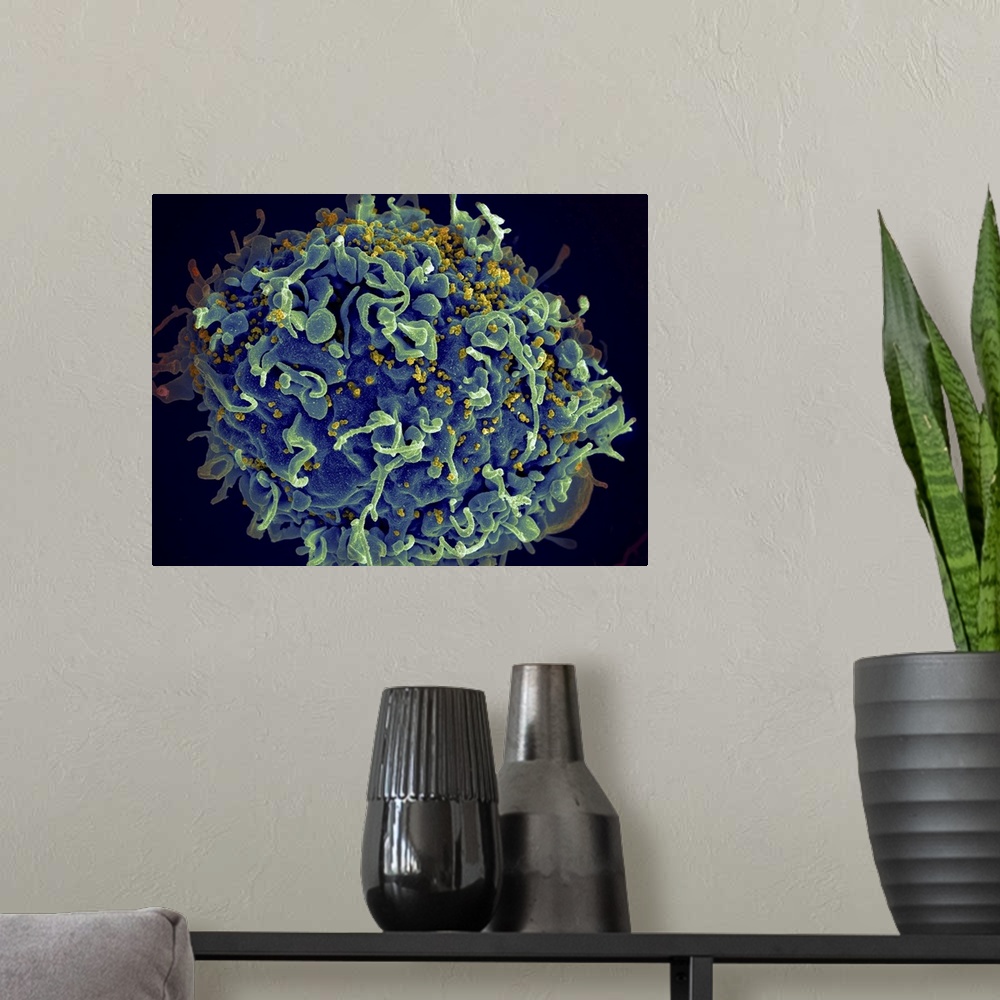 A modern room featuring Scanning electron micrograph of HIV particles infecting a human H9 T cell.