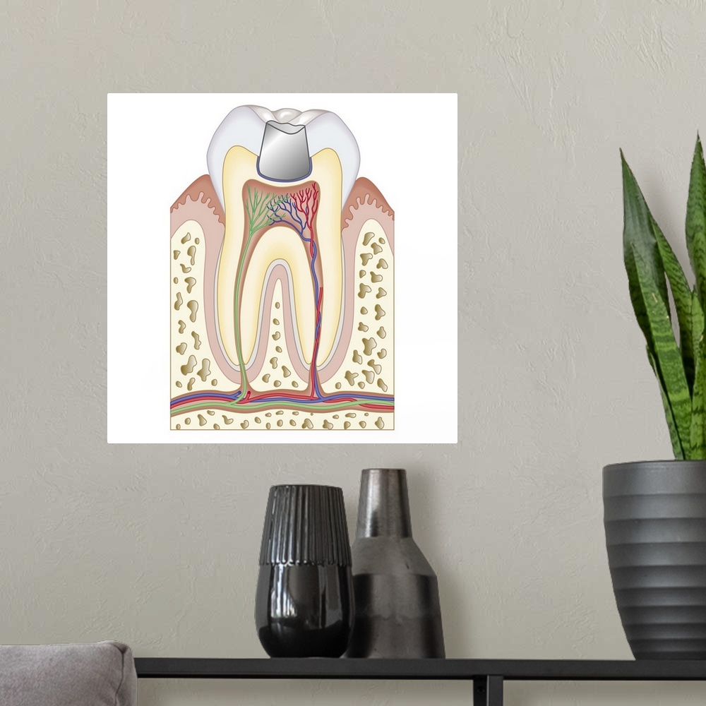 A modern room featuring Cross section biomedical illustrationBiomedical illustration of dental filling