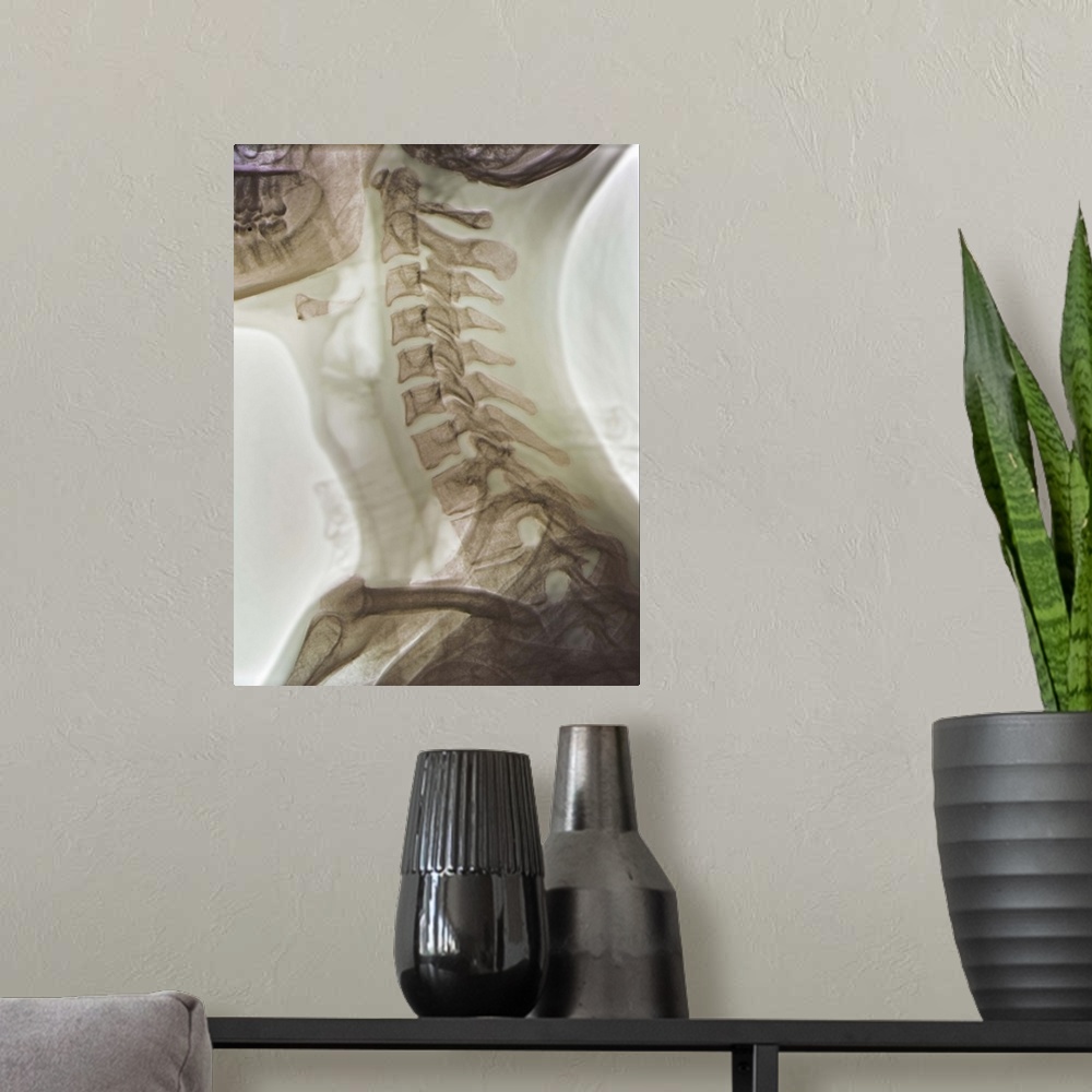 A modern room featuring Normal neck. Coloured X-ray of the cervical spine of a 27 year old.