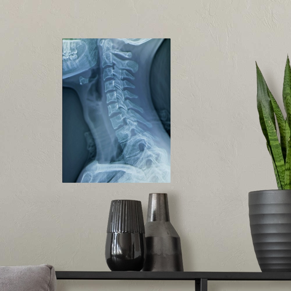 A modern room featuring Normal neck. Coloured X-ray of the cervical spine of a 27 year old.