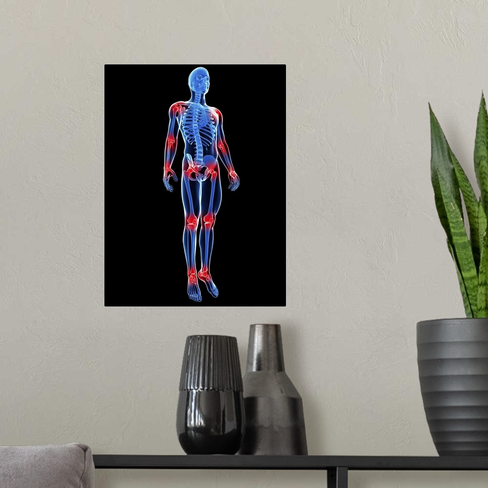 A modern room featuring Joint pain, conceptual computer artwork.