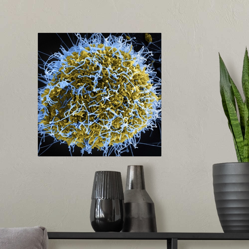 A modern room featuring Colorized scanning electron micrograph of filamentous Ebola virus particles (blue) budding from a...