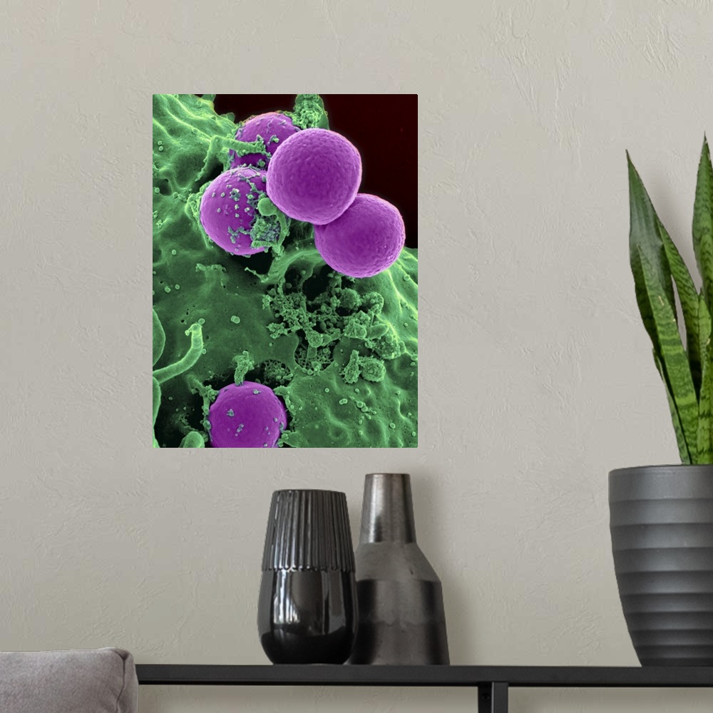 A modern room featuring Scanning electron micrograph of a human neutrophil ingesting MRSA.