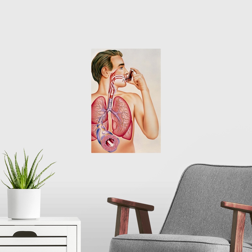A modern room featuring Asthma inhaler. Artwork showing the effects of an asthma inhaler containing bronchodilator drugs ...