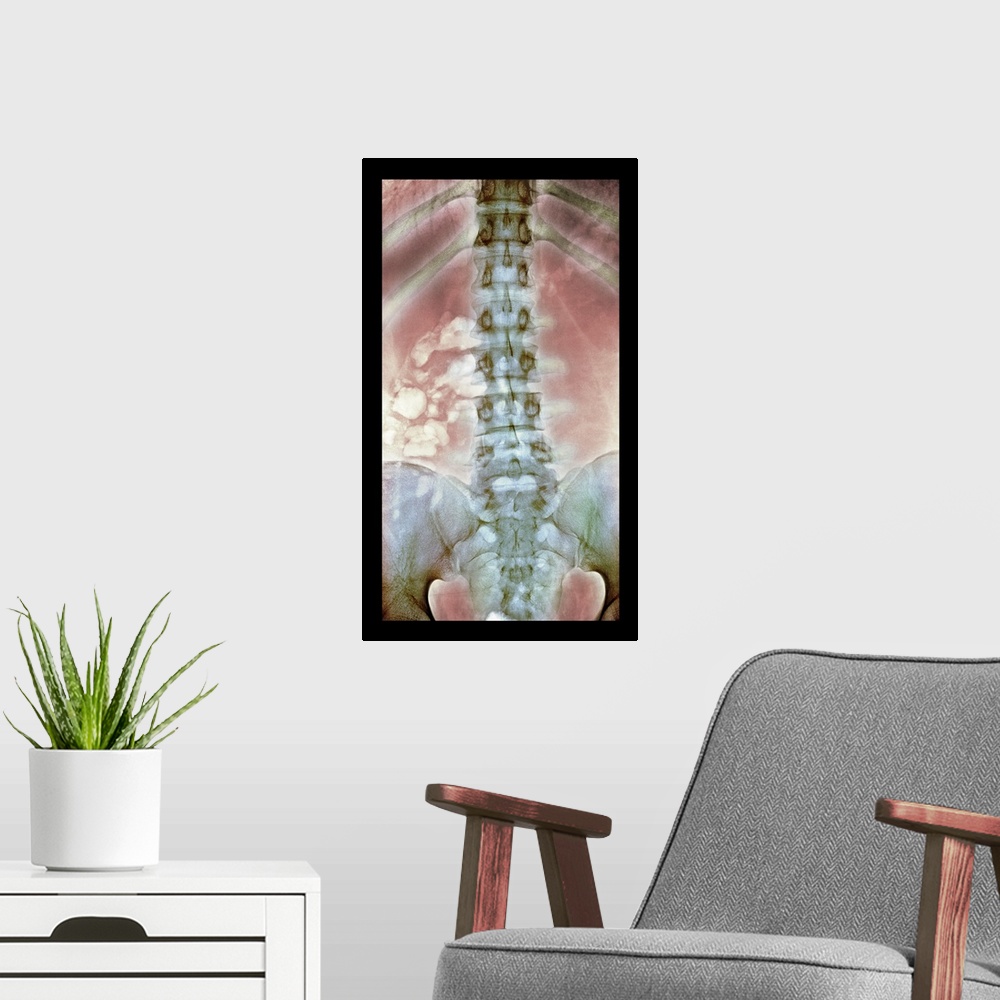 A modern room featuring Normal spine. Coloured X-ray of the spine of a 24 year old man.