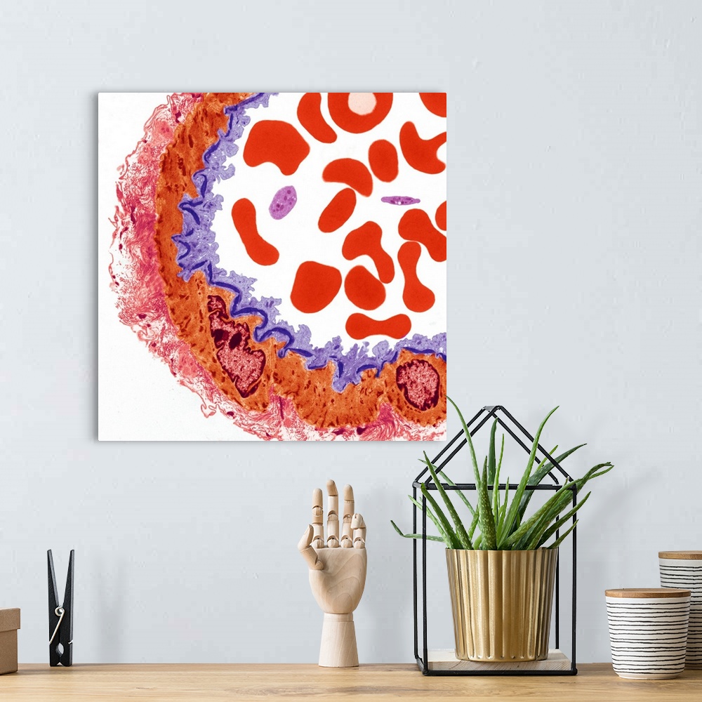 A bohemian room featuring Artery. Coloured transmission electron micrograph (TEM) of a transverse section through part of a...