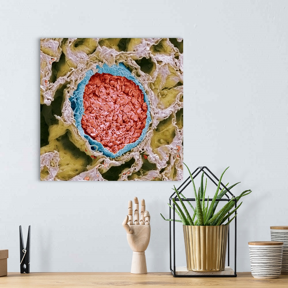 A bohemian room featuring Blood-filled pulmonary arteriole. Coloured scanning electron micrograph (SEM) of a section throug...