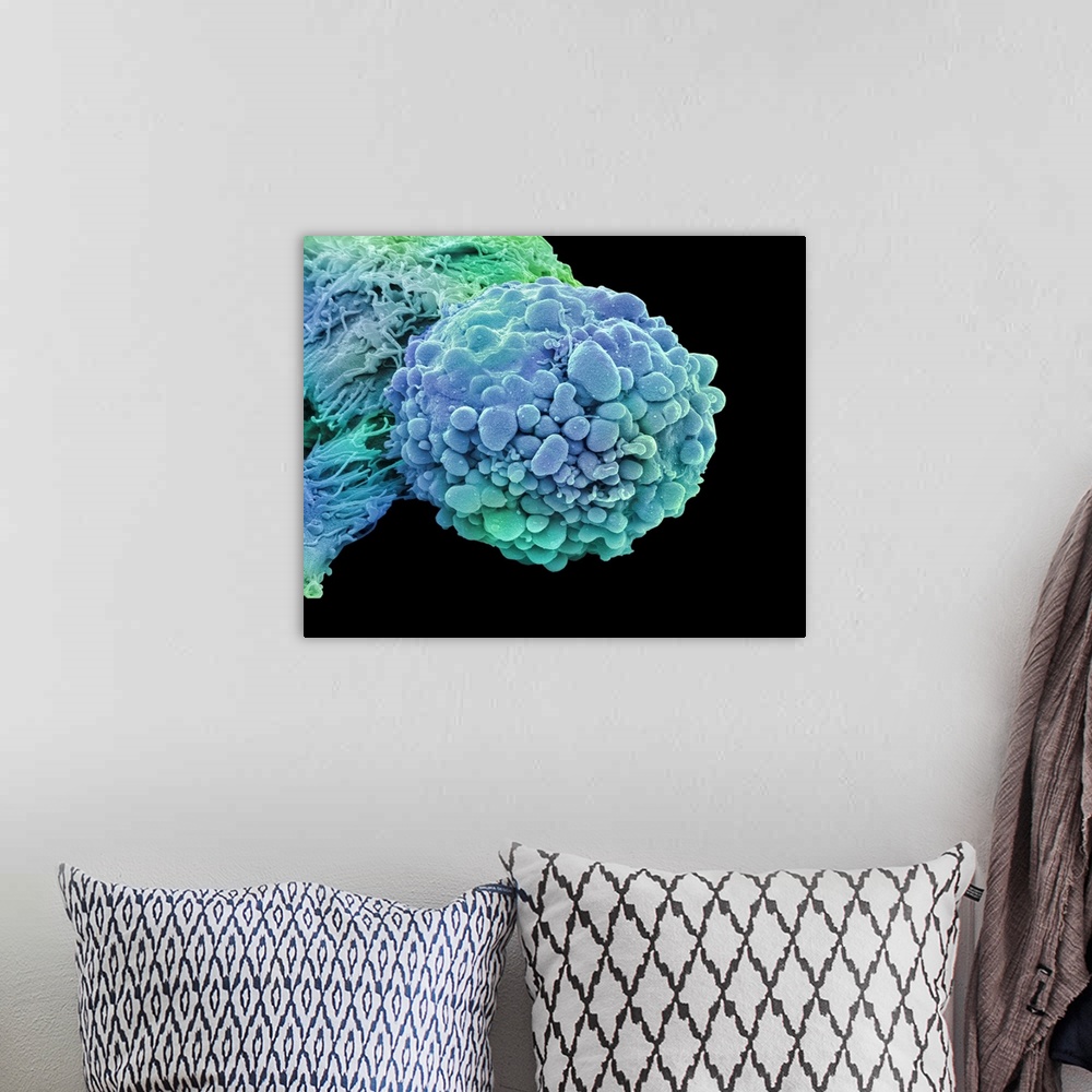 A bohemian room featuring Brain cancer cell. Coloured scanning electron micrograph (SEM) of a cancerous cell from an oligod...
