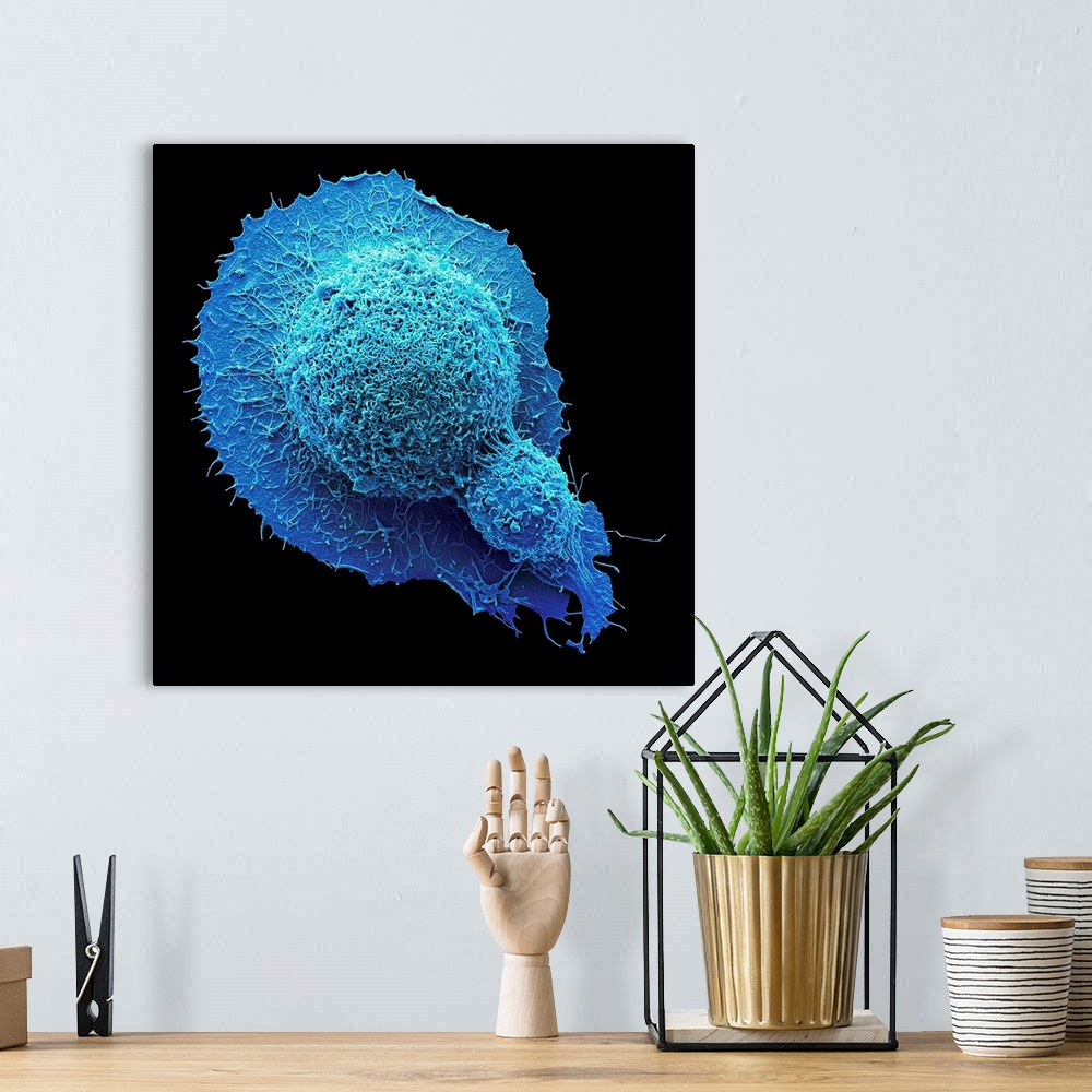 A bohemian room featuring Colorectal cancer cell. Coloured scanning electron micrograph (SEM) of a cancer cell from the hum...