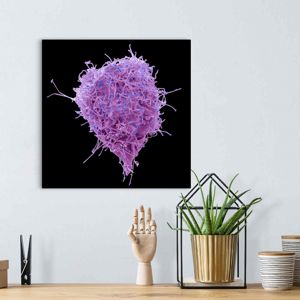 A bohemian room featuring HIV infected 293T cell. Coloured scanning electron micrograph (SEM) of a 293T cell infected with ...