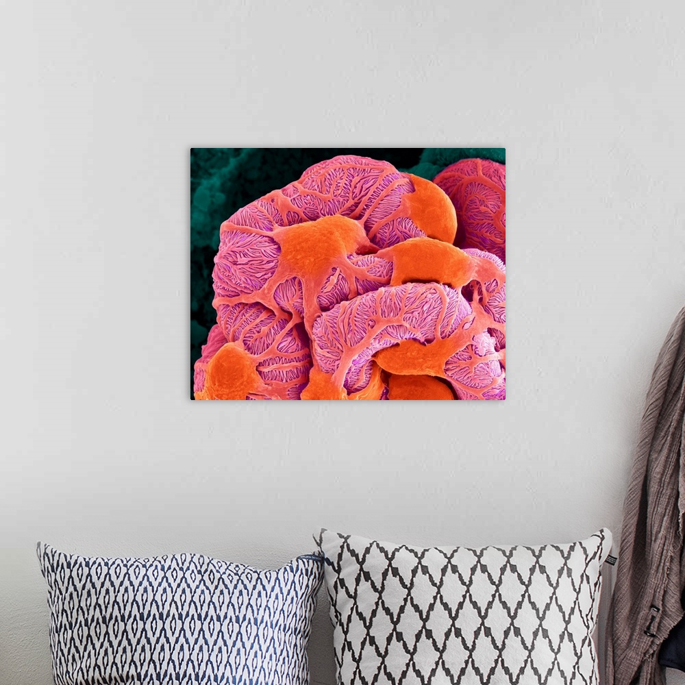 A bohemian room featuring Coloured scanning electron micrograph (SEM) of a kidney glomerulus (podocytes and capillaries of ...