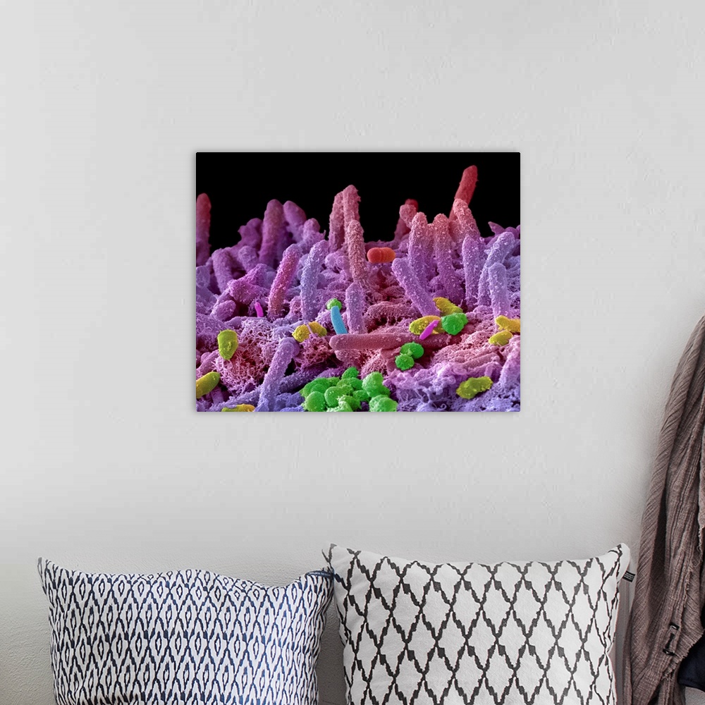A bohemian room featuring Oral bacteria. Coloured scanning electron micrograph (SEM) of mixed oral bacteria. The mouth cont...
