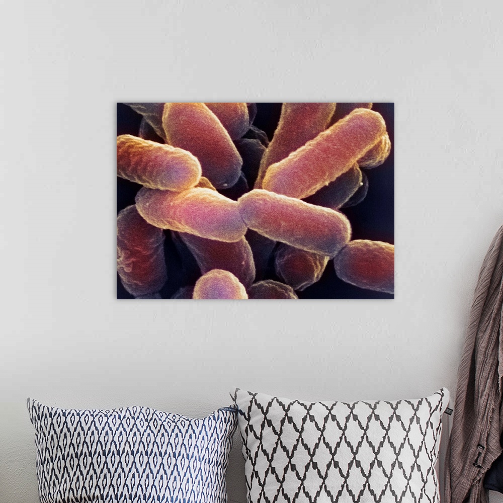 A bohemian room featuring E. coli 0157:H7 bacteria. Coloured scanning electron micrograph (SEM) of Escherichia coli 0157:H7...