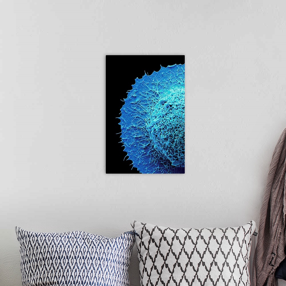 A bohemian room featuring Colorectal cancer cell. Coloured scanning electron micrograph (SEM) of part of a cancer cell from...