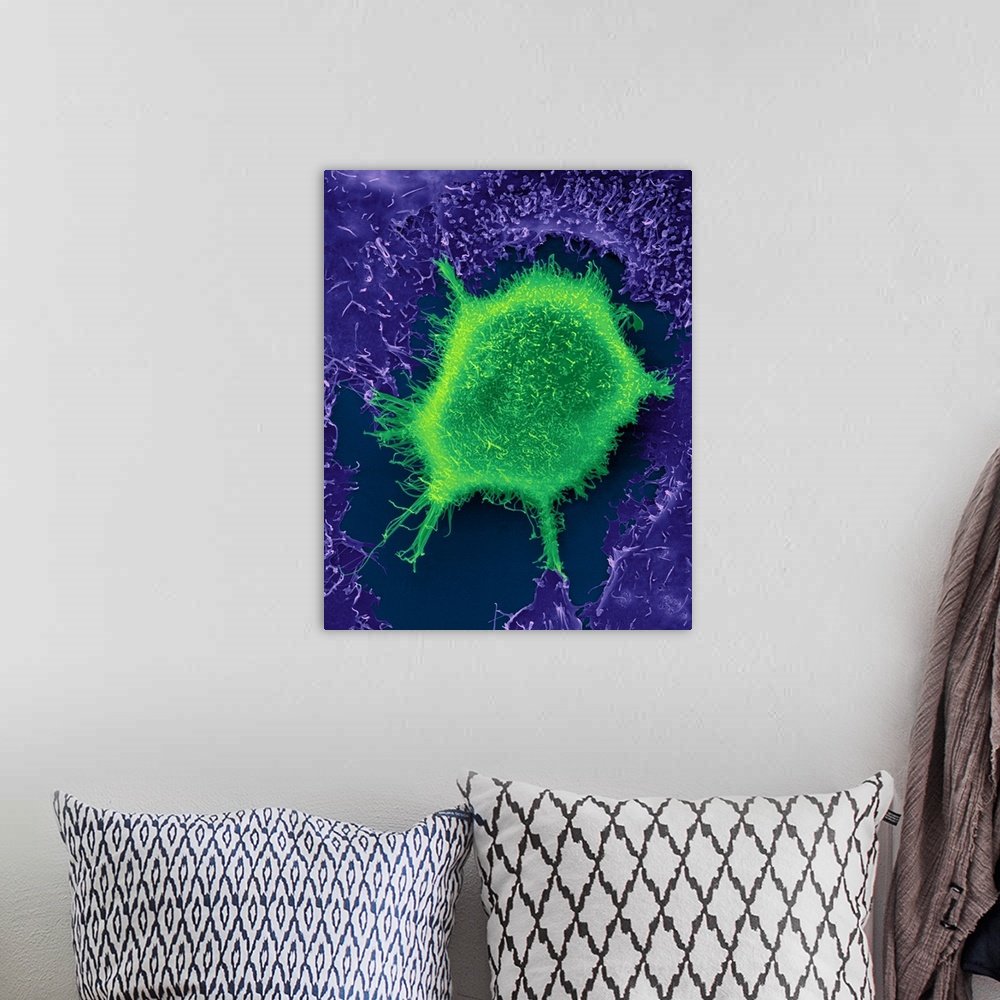 A bohemian room featuring Human lung epithelial cancer cell among healthy epithelial cells, coloured scanning electron micr...