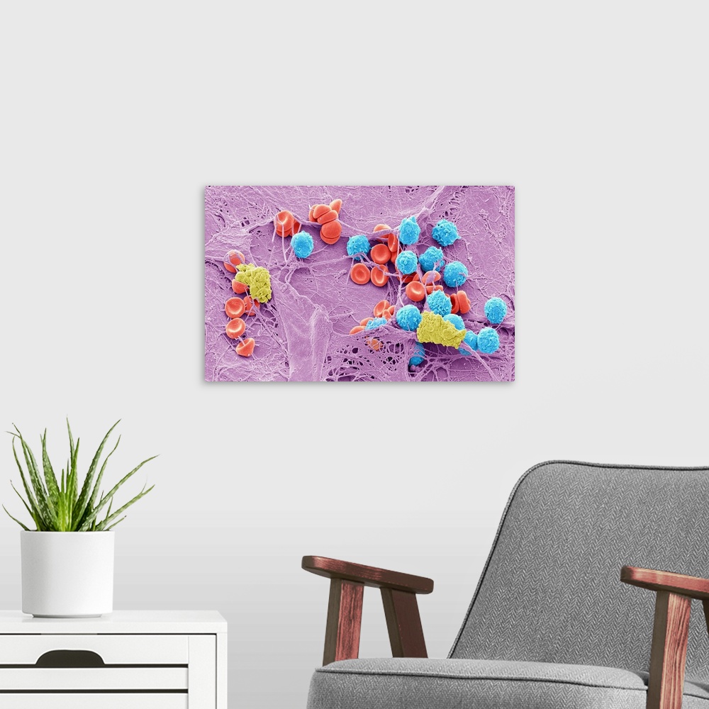 A modern room featuring Skin wound, Coloured scanning electron micrograph (SEM). A fibrin mesh supports a variety of bloo...