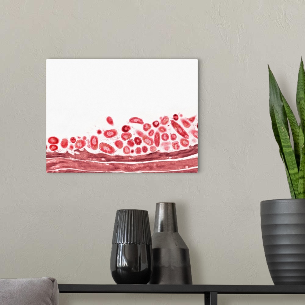 A modern room featuring Tongue bacteria. Coloured transmission electron micrograph (TEM) of bacteria (red) on the surface...