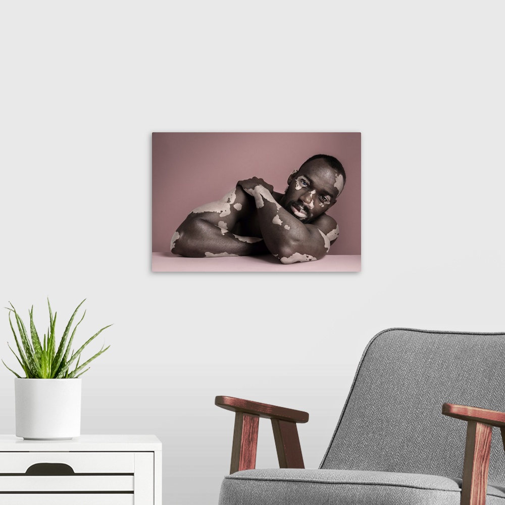 A modern room featuring Fashion Portrait Of Black Man With Vitiligo