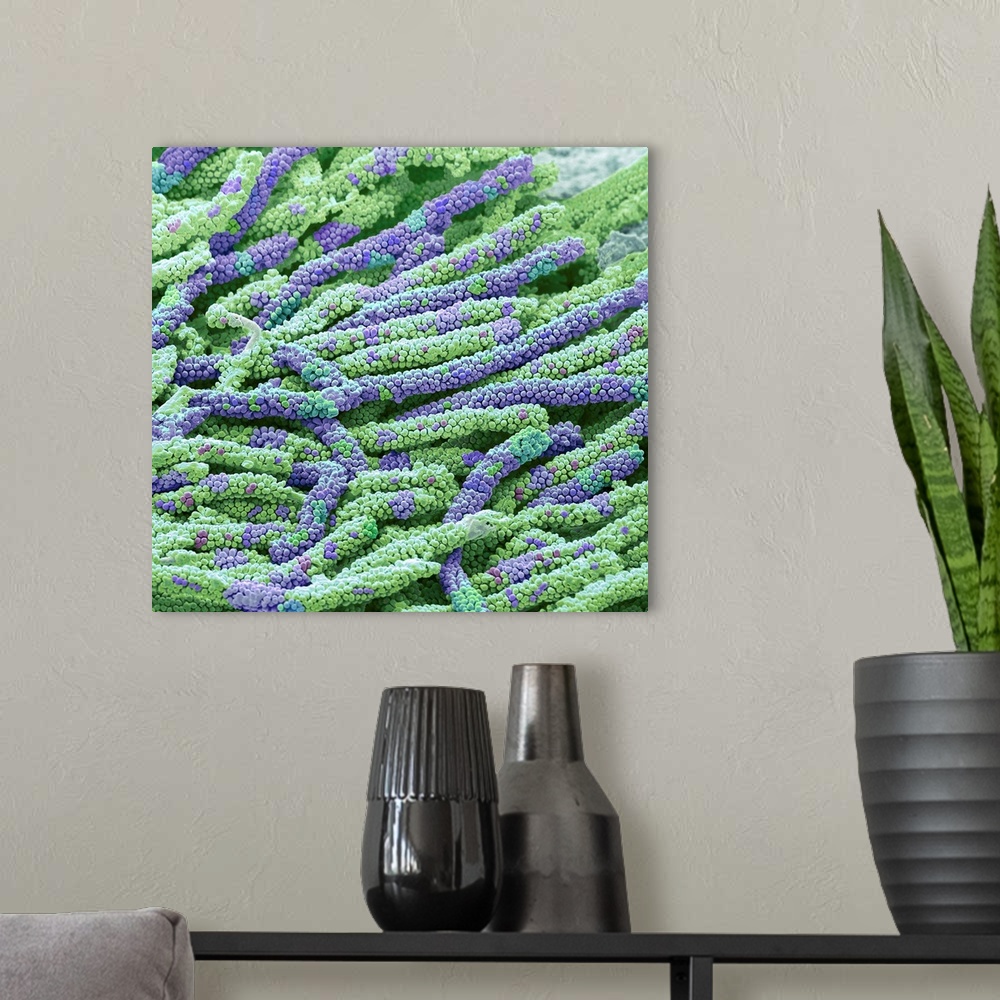 A modern room featuring Tooth bacteria. Coloured scanning electron micrograph (SEM) of bacteria from the surface of a hum...