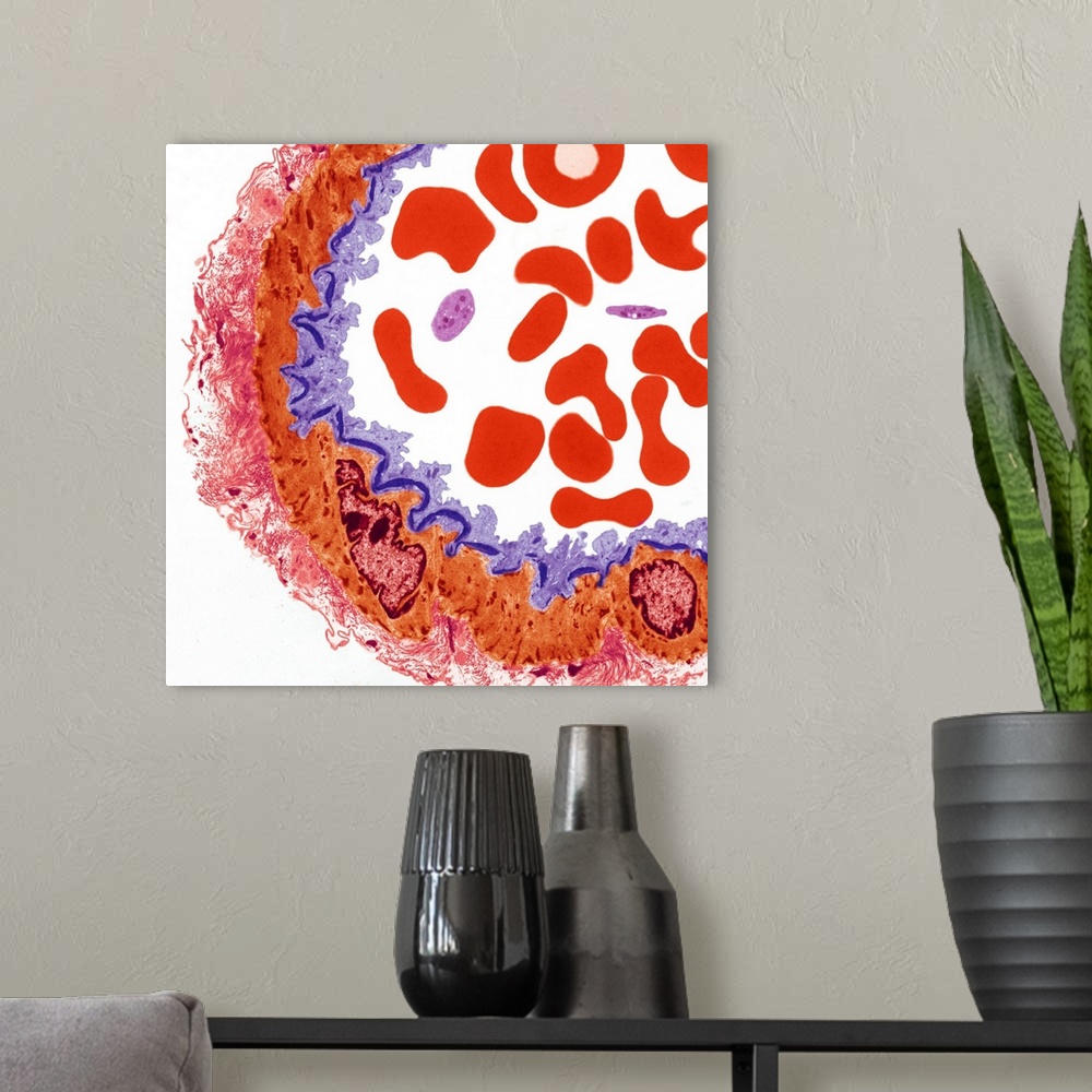 A modern room featuring Artery. Coloured transmission electron micrograph (TEM) of a transverse section through part of a...