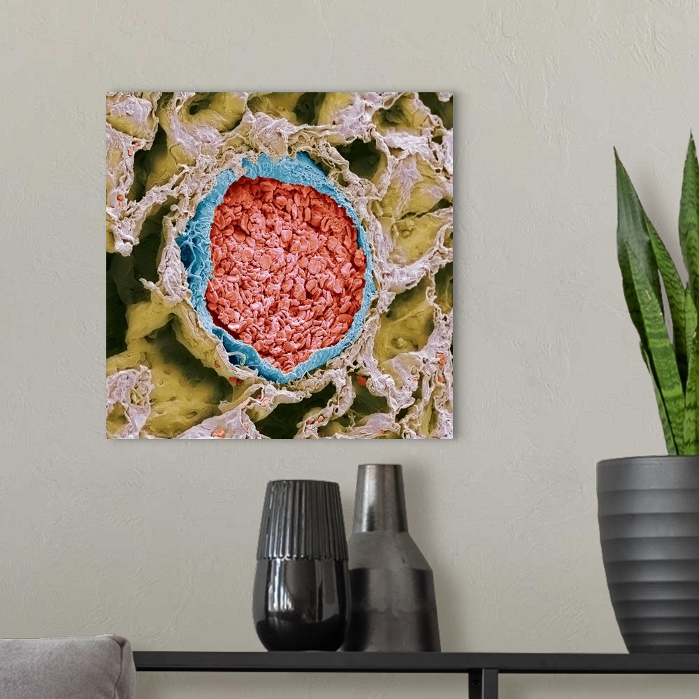 A modern room featuring Blood-filled pulmonary arteriole. Coloured scanning electron micrograph (SEM) of a section throug...
