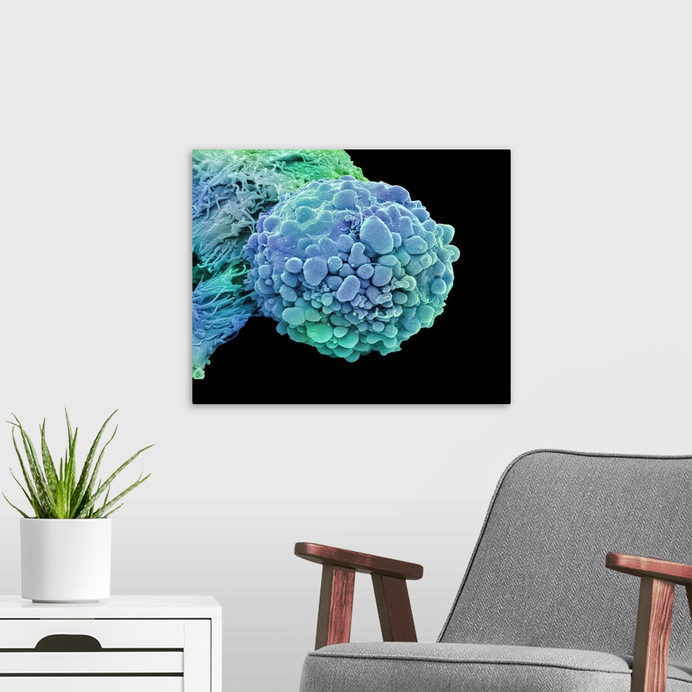 A modern room featuring Brain cancer cell. Coloured scanning electron micrograph (SEM) of a cancerous cell from an oligod...