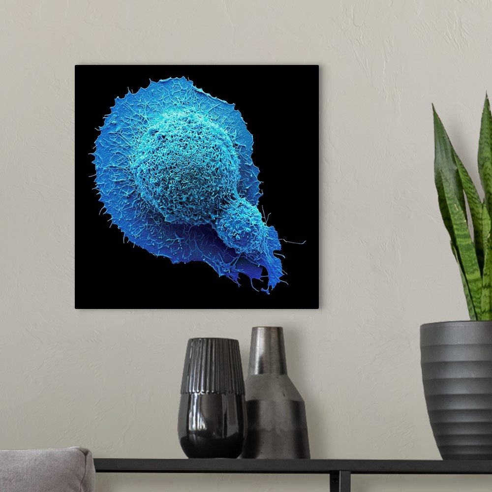 A modern room featuring Colorectal cancer cell. Coloured scanning electron micrograph (SEM) of a cancer cell from the hum...