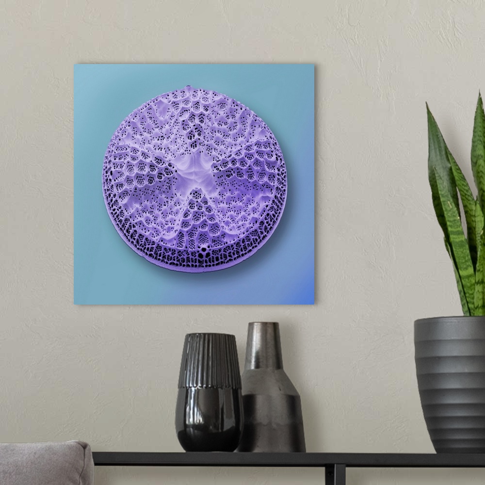 A modern room featuring Diatom. Coloured scanning electron micrograph (SEM) of an Actinoptychus species diatom. Diatoms a...