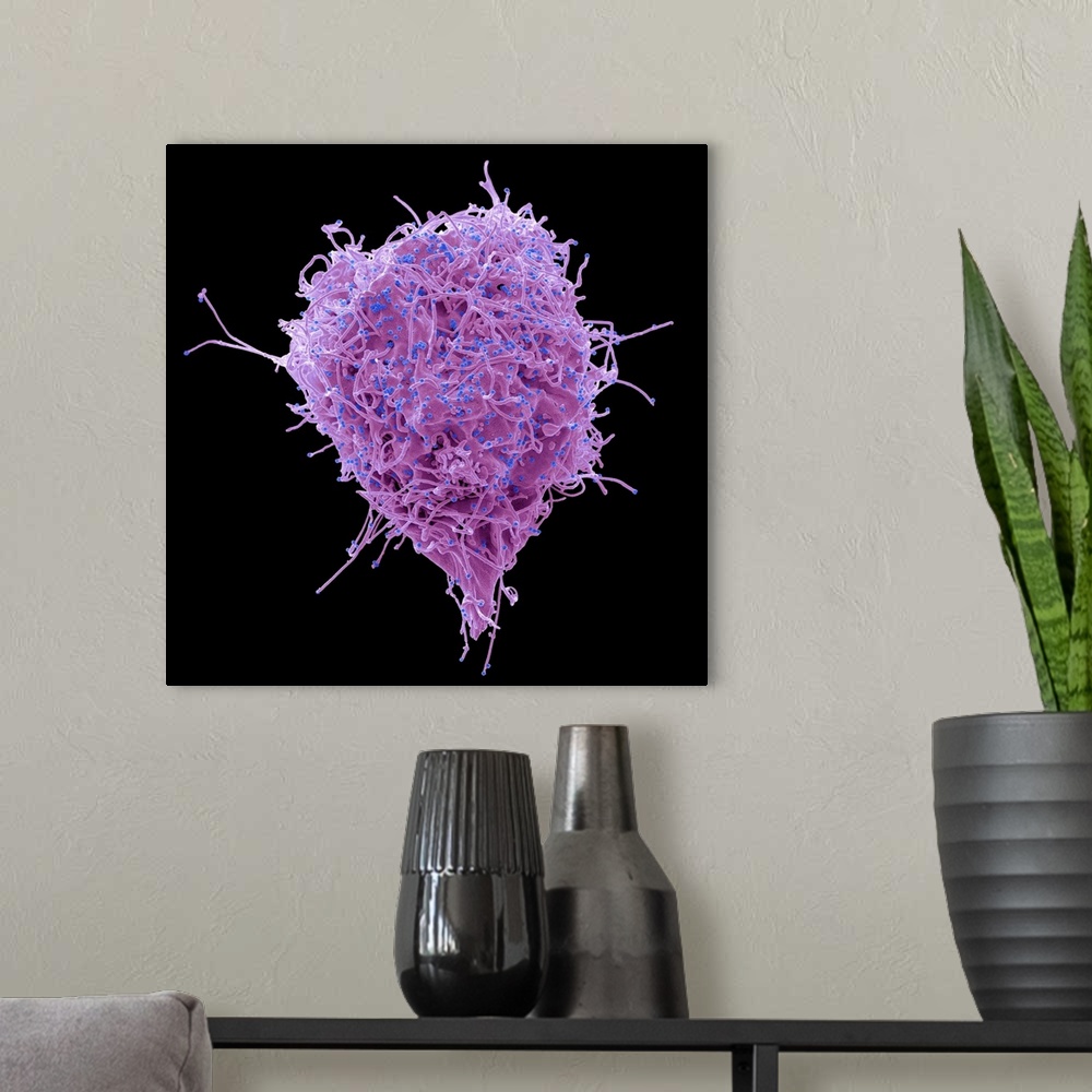 A modern room featuring HIV infected 293T cell. Coloured scanning electron micrograph (SEM) of a 293T cell infected with ...