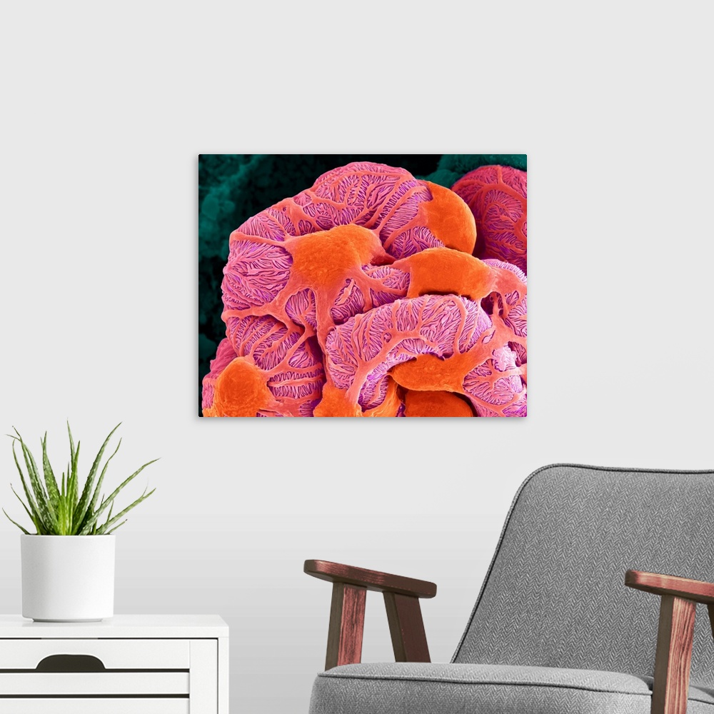A modern room featuring Coloured scanning electron micrograph (SEM) of a kidney glomerulus (podocytes and capillaries of ...