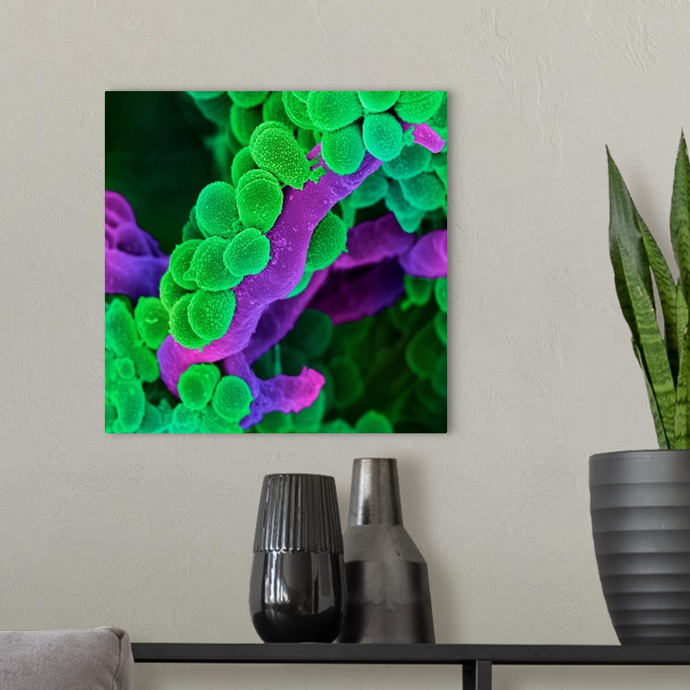 A modern room featuring Oral Streptococcus bacteria. Coloured scanning electron micrograph (SEM) of chains of Streptococc...