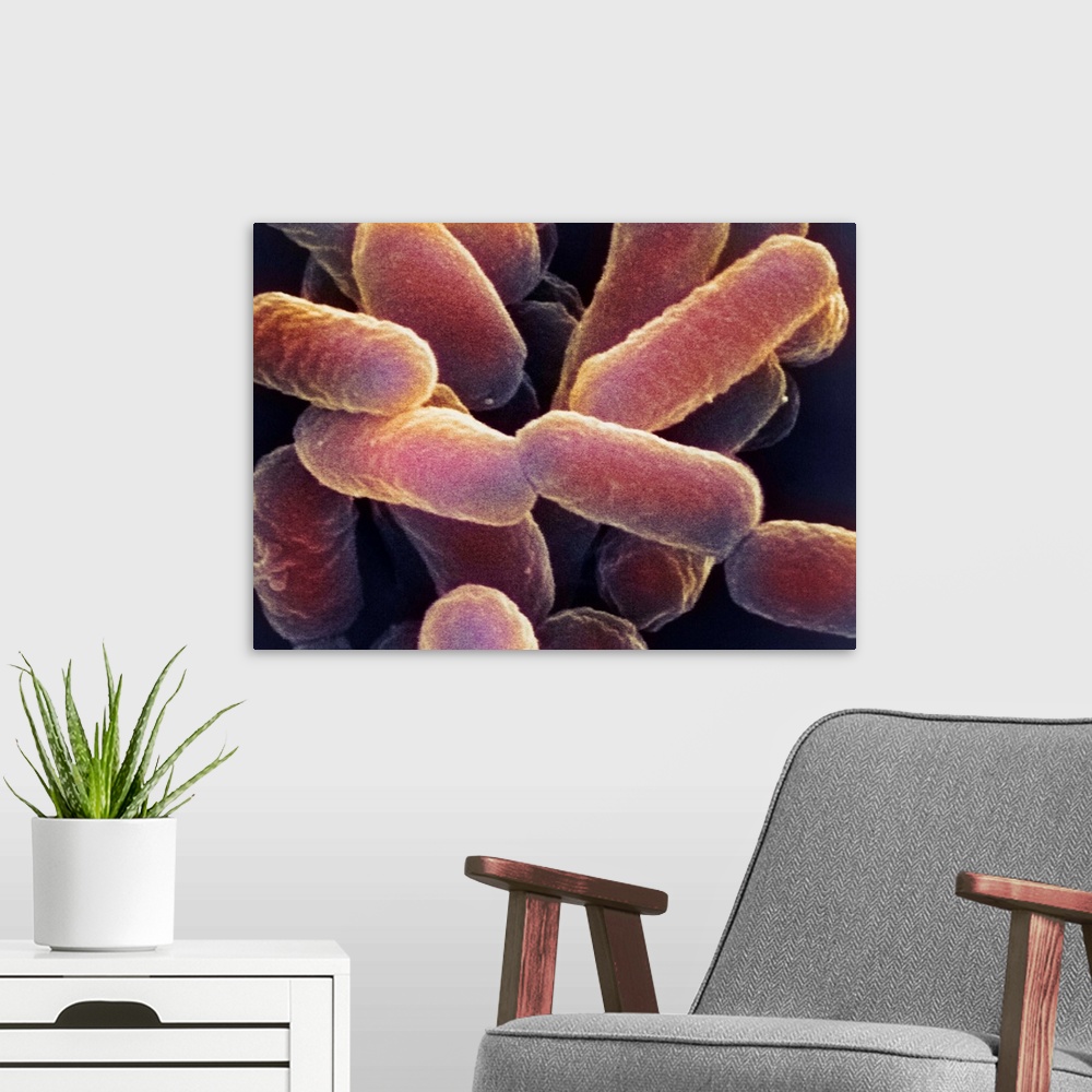 A modern room featuring E. coli 0157:H7 bacteria. Coloured scanning electron micrograph (SEM) of Escherichia coli 0157:H7...