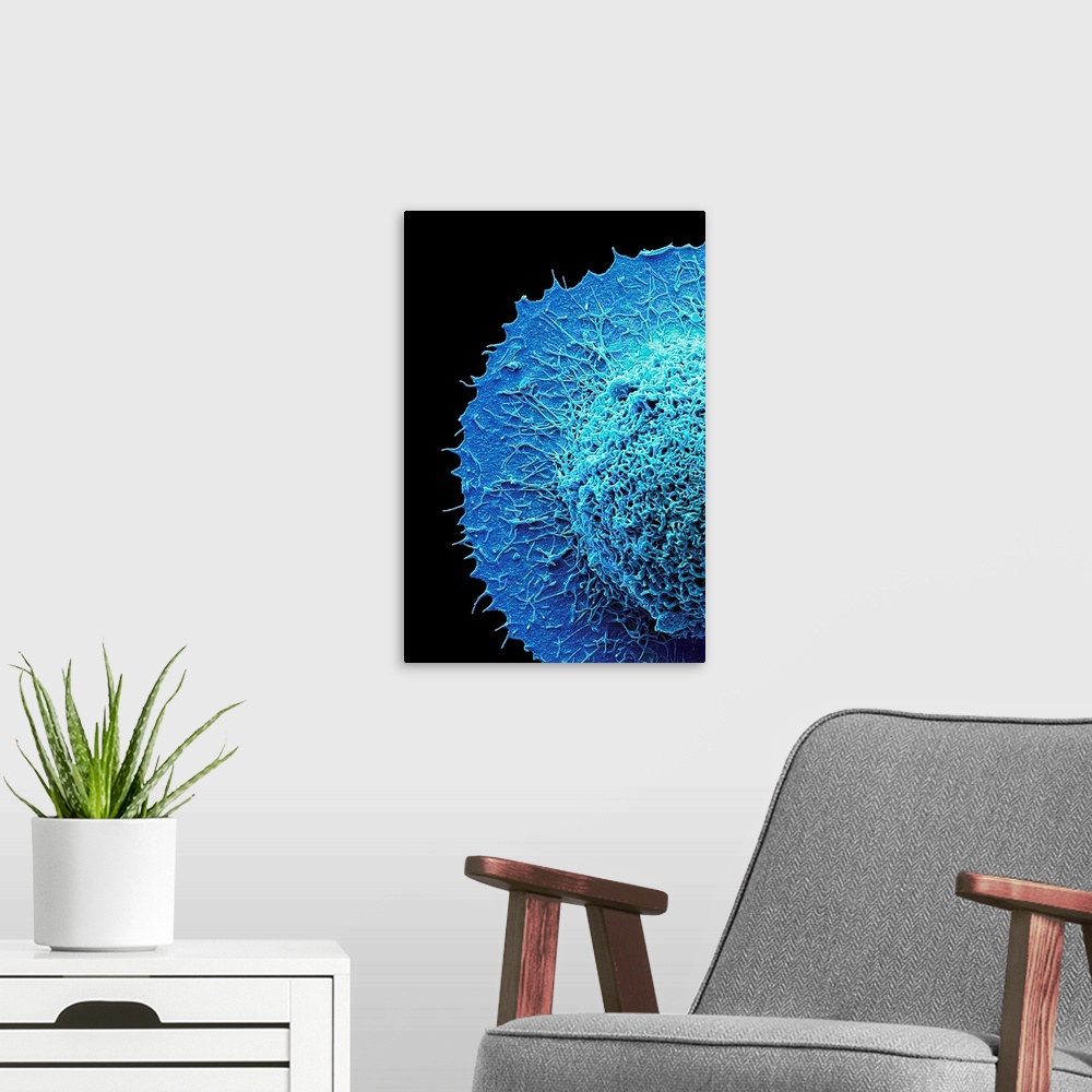 A modern room featuring Colorectal cancer cell. Coloured scanning electron micrograph (SEM) of part of a cancer cell from...